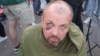 Следы побоев у освобожденного протестующего. Минск, 14 августа 2020 года