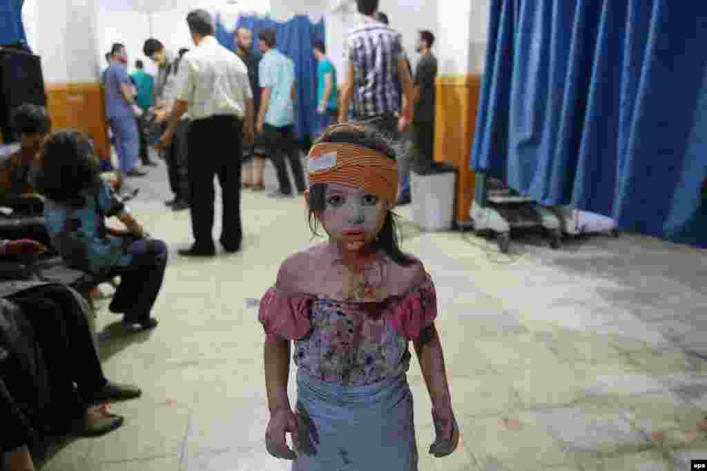 Second Prize Stories in the General News Category was won by Syrian AFP photographer Abd Douman. This image from the series is of a young victim of the Syrian civil war in the city of Douma. (August 22, 2015)