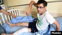 Еревандағы қақтығыстарда зардап шеккен журналистердің бірі. 30 шілде 2016 жыл.