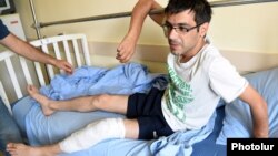 Один из пострадавших в столкновениях в Ереване журналистов. 30 июля 2016 года. 