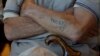 Një i mbijetuar i Holokaustit shihet me numrin identifikues të bërë tatu nga nazistët.