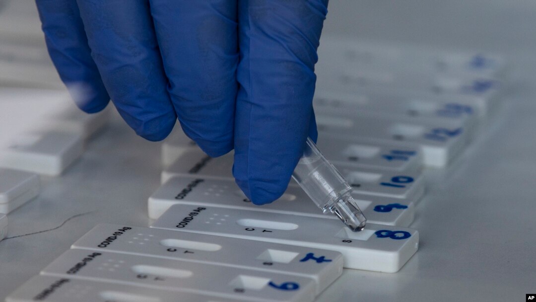 În ultimele 24 de ore au fost efectuate 22.133 de teste RT-PCR (13.421 în baza definiției de caz și a protocolului medical și 8.712 la cerere) și 8.166 de teste rapide antigenice.
