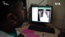 Глобальна боротьба з туберкульозом «відкинута на 12 років назад» через пандемію COVID