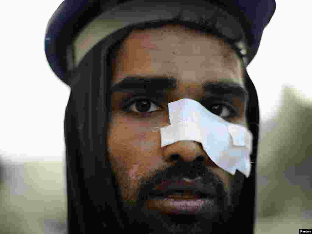 Тәхрир мәйданындагы бәрелешләрдә яраланган демонстрацияче. 9 февраль 2011.