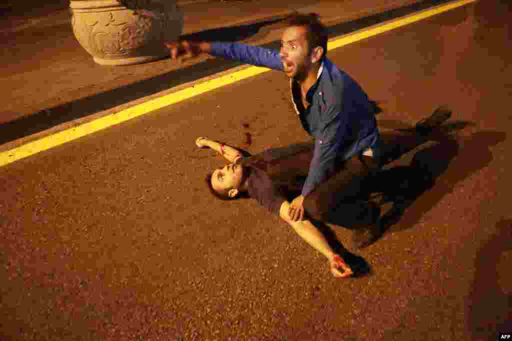 An injured man lies on the ground during a protest against the attempted coup.