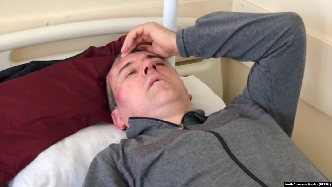 Sirazhutdin Datsiyev following the attack