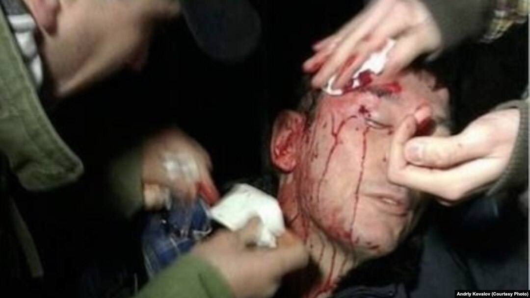 Former Interior Minister Yuriy Lutsenko was among those wounded in clashes between protesters and riot police in Kyiv late on January 10.