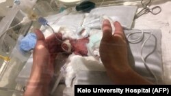 Шу кунгача Токиода 268 грамм вазнда туғилган чақалоқ ҳаёти сақлаб қолинган энг кичик вазндаги бола бўлган эди.