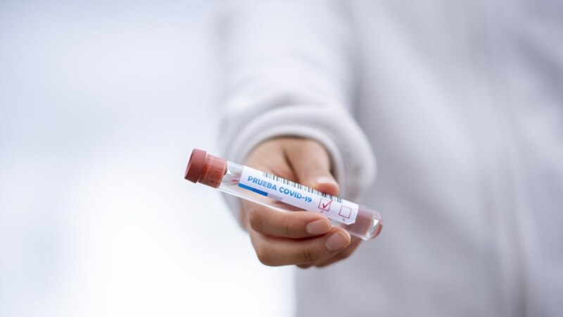 იანვრის ბოლოდან საქართველოში ჩატარებულია 860 ათასზე მეტი PCR ტესტი - გამყრელიძე