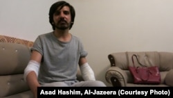 Pakistani journalist Asad Ali Toor, pictured after the attack on May 26. 