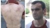 Armenia- Andranik Aslanian, an opposition activist who claims to have been beaten by police, 19Jul2016.