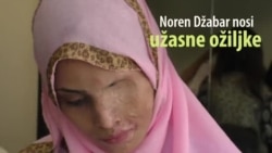 Nova šansa za pakistanske žene - žrtve napada kiselinom