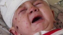 راکټي حملې د ۴ میاشتني ماشوم ژوند له نامعلوم برخلیک سره مخ کړ