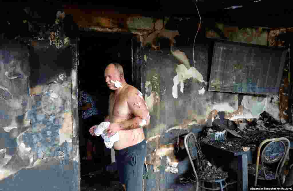 An injured local man stands inside his destroyed house following shelling, which local Russian-installed authorities called a Ukrainian military strike, in Makiyivka in Ukraine&#39;s Russian-occupied Donetsk region.