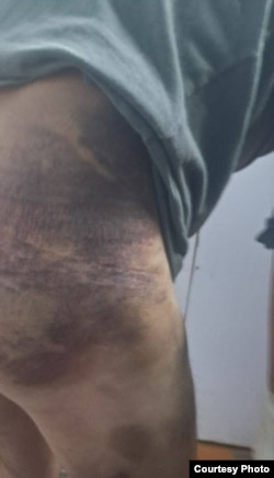 ნაცემი სამხედრო - სერგეი ბოდალევი.