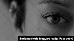 Kép: Endometriózis Magyarország/FB
