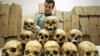 Bosnia-Herzegovina -- Bosnian pathologist Rifat Kesetovic as he examines skulls of victims in a hospital in Tuzla, 28Mar1997