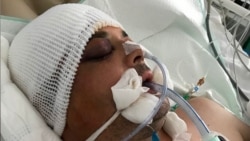 Roman Sopin died days after being admitted to hospital with a severe head injury, which his family suspect was the result of violence while he was in custody. 