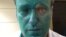 Aleksei Navalny's right eye was badly damaged in the attack.