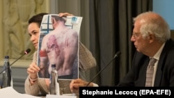 Лидер оппозиции Беларуси Светлана Тихановская показывает фото человека со следами пыток на неформальной встрече с министрами иностранных дел стран ЕС. Брюссель, 21 сентября 2020 года.