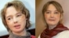 Француженка Изабель Динуар, первая женщина с пересаженным лицом 