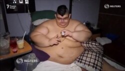 Фарбеҳтарин марди рӯйи олам ба амалиёти ҷарроҳӣ мувофиқат кард