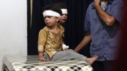 BMG: Siriýa boýunça gepleşikleri dikeltmek maslahat edilýär