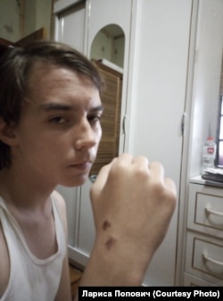 Павел Попович на третий день после избиения полицейскими при задержании