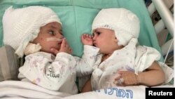 تصویری از دوقلوها پس از عمل جراحی موفقیت‌آمیز آن‌ها