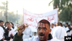 Shi'ite Muslims perform "tabrir" -- the cutting of the forehead -- during the culmination of the Ashura ceremonies in Baghdad.