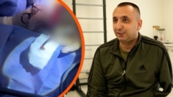«Народжений у сорочці» воїн: понад 30 годин із турнікетом, а в серці – уламок 