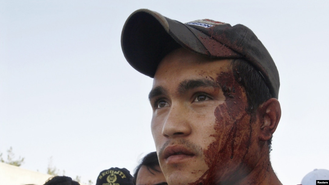 An ethnic Hazara Shi'a is smeared in blood after bringing victims of a shooting to a local hospital in Quetta in May 2011.