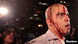 Фотагалерэя: Акцыі пратэсту ў Бразыліі