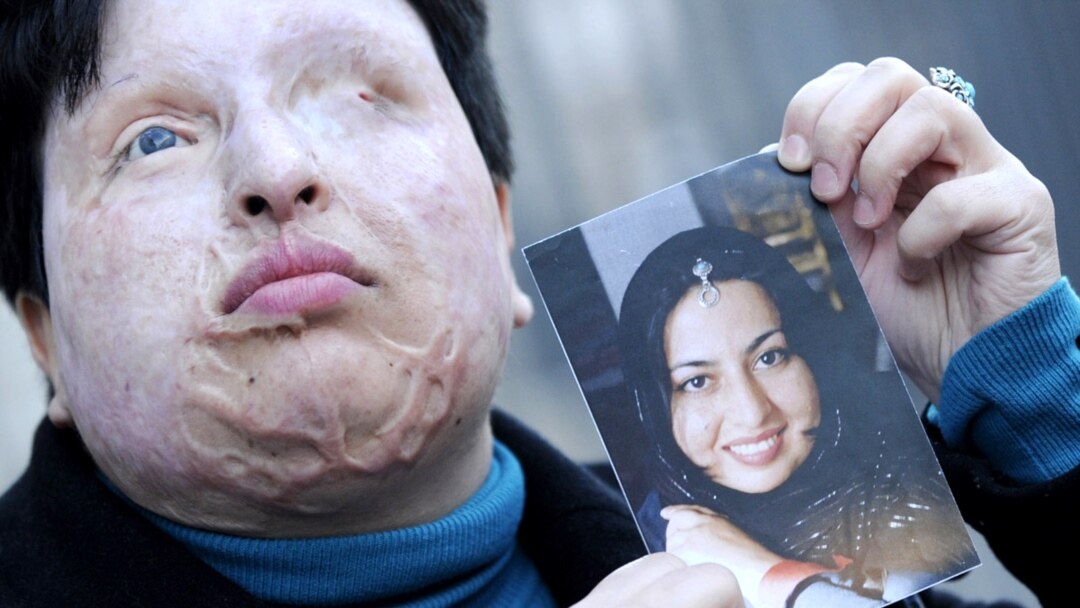 Sochli anal porno Qora erkaklar bilan orgiyadagi etuk ayollar