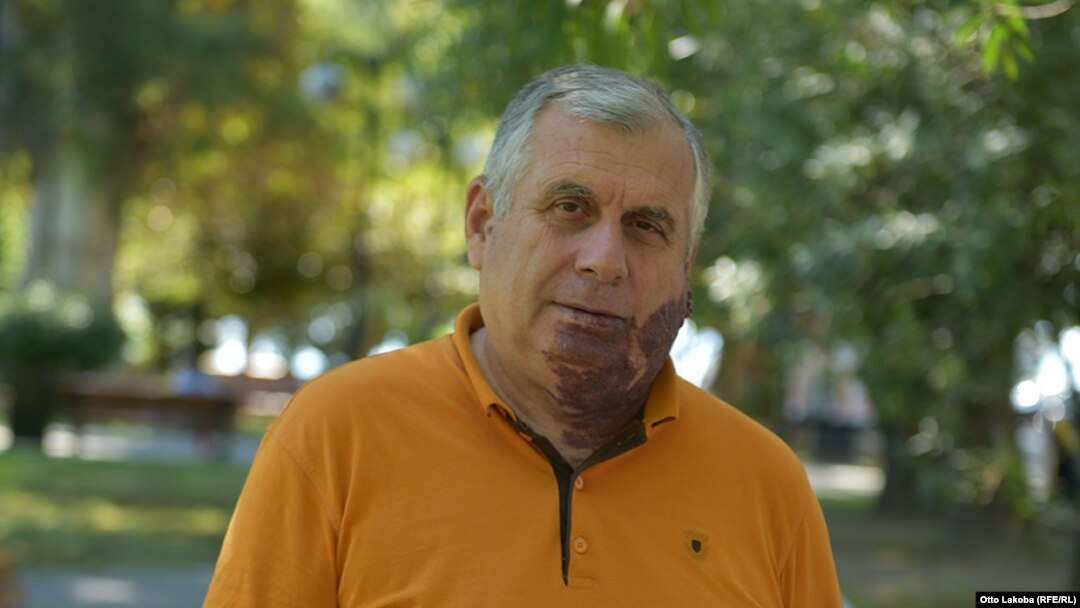 Станислав Лакоба