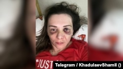 Джамиля Гарунова. Фотография из телеграм-канала главы Общественной наблюдательной комиссии Дагестана Шамиля Хадулаева, опубликованная 11 июня 2026 г.