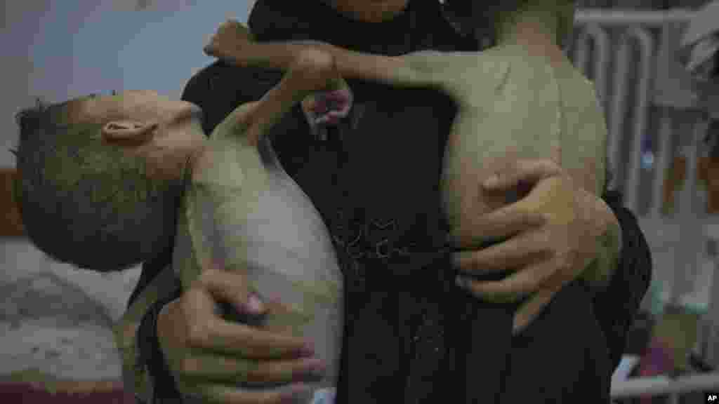 A gázai Rantisi Kórházban Ahmed Basal orvos azt mondja, hogy ha egyáltalán kapható tápszer, kartononként akár 58 dollárba is kerül, míg az anyák maguk is alultápláltak ahhoz, hogy szoptassák gyermekeiket. A képen Omniya Mahra tartja karjában négy- és hároméves gyermekét, akik az alultápláltság mellett genetikus idegrendellenességben is szenvednek