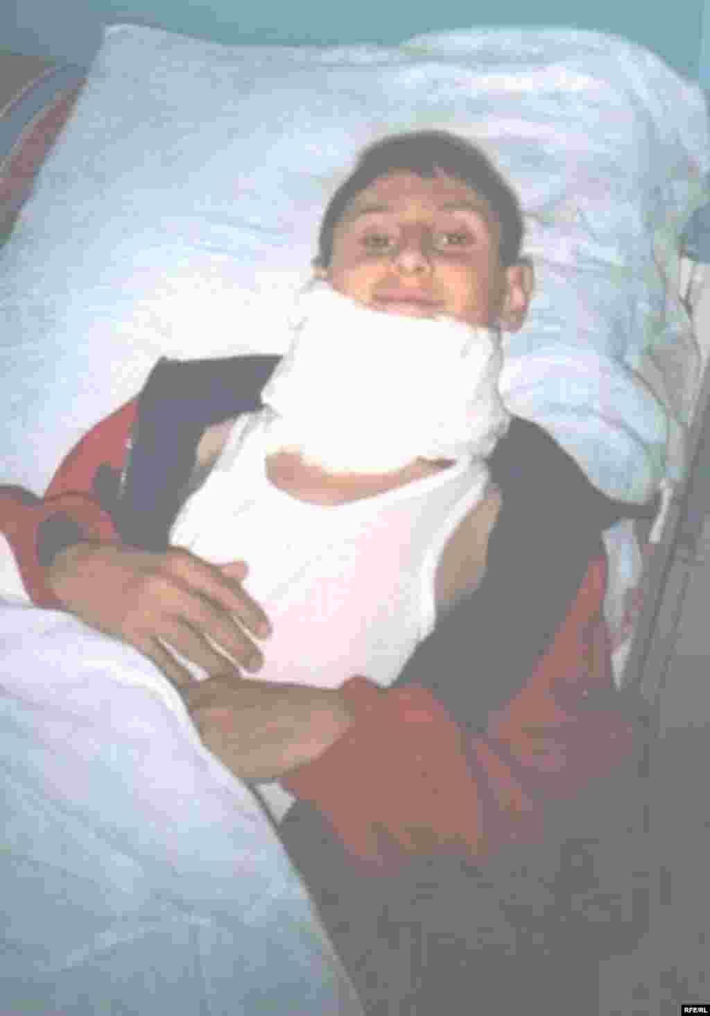 Çernobılın Azərbaycan izləri #7