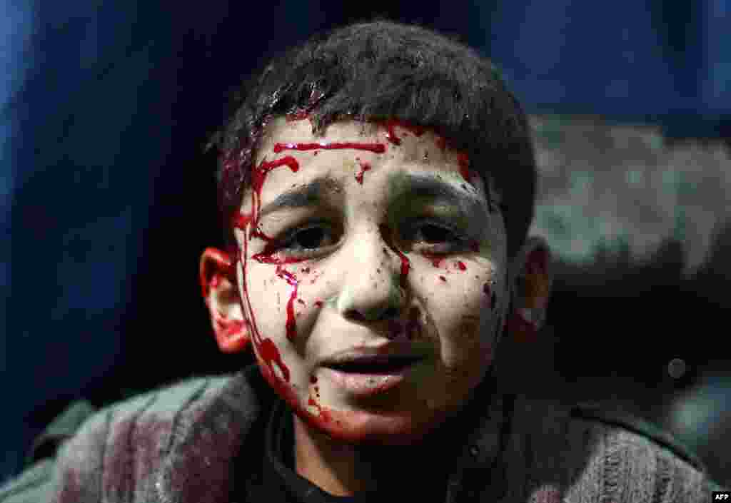 An injured Syrian child waits for treatment at a makeshift hospital in the rebel-held area of Douma, northeast of the capital, Damascus, following reported air strikes by forces loyal to President Bashar al-Assad. (AFP/Adb Doumany)