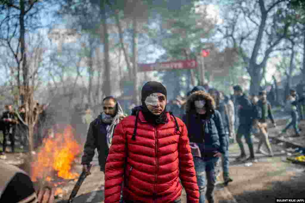 An injured man walks away from clashes with Greek police in the buffer zone along the Turkey-Greece border near Edirne, Turkey.