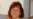 'I Felt Like I Was On Fire': Volgograd Blast Survivor Describes Her Ordeal