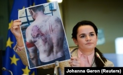 Fényképet mutat egy megvert tüntetőről az Európai Parlamentben 2020. szeptember 21-én.