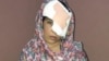 Salema Akhundzada endured 11 hours on poor roads before she and her mother arrived at Kabul's Emergency Hospital for treatment. The doctors there were unable to save her left eye.