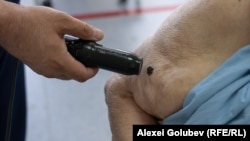 Pentru a identifica alunițele cu risc crescut de malignizare, medicii folosesc testul ABCDE.