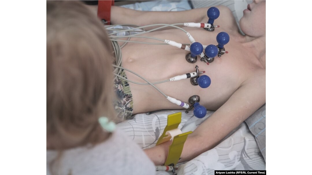 Doctors perform an EKG on a boy named Artyom.