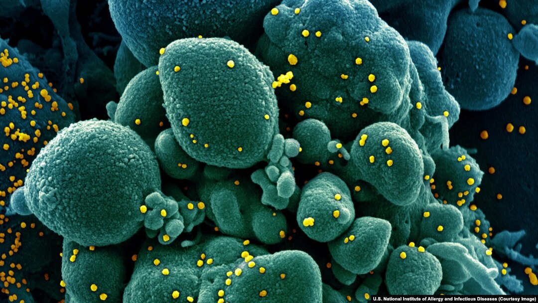 Imagine a unei celule (în verde) infestate cu noul coronavirus (în galben), realizată de cercetătorii americani