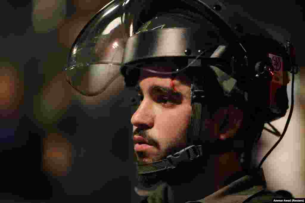 Egy megsebesült izraeli rendőr a zavargásokon.