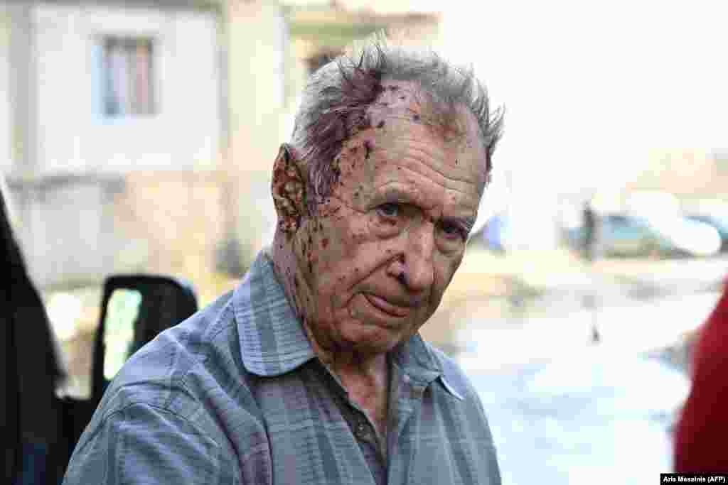 Ранет жител на градот Чугвив чека да му биде укажана лекарска помош, 24 февруари 2022