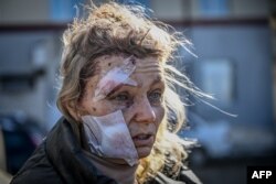 A wounded woman stands outside a hospital after the bombing of the eastern Ukraine town of Chuguyiv on February 24, 2022.