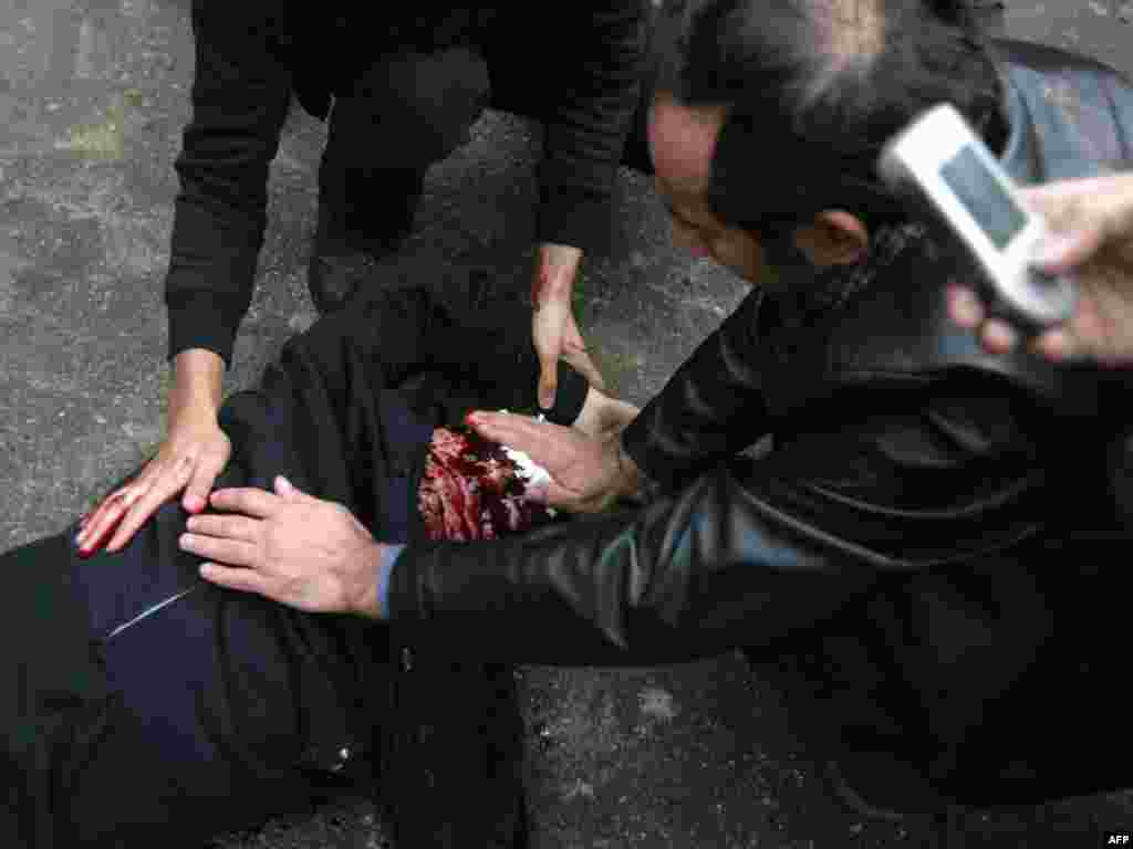 Iranian protesters try to staunch the bleeding from a man reportedly shot. (AFP)